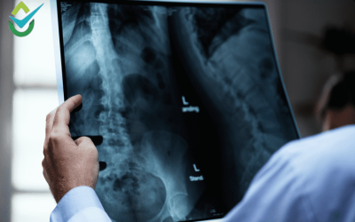 How to Dispose of X-Ray Film Safely