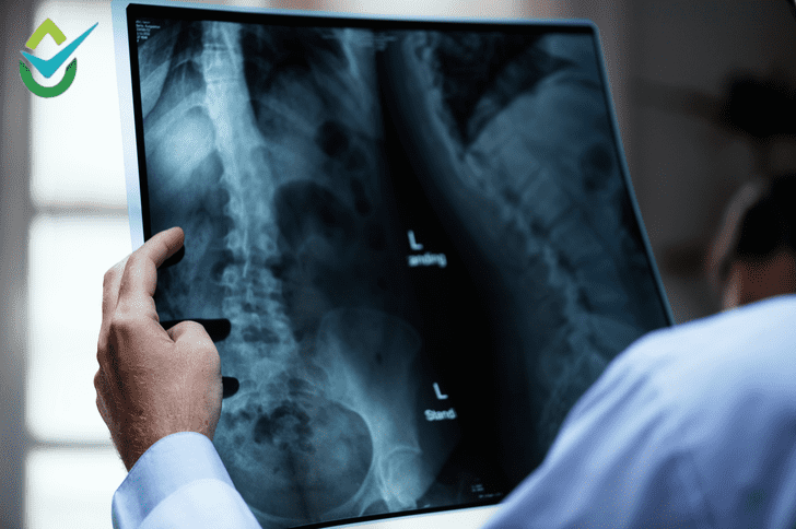 how to dispose of x-ray films safely and responsibly, showing proper handling of medical imaging materials for eco-friendly disposal.